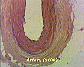 (artery) artery5.JPG