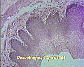 (oesophagus) oesophagus2.JPG