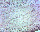 (small intestine) small intestine19.JPG