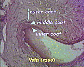 (vein) vein3.JPG