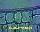 (leaf of dicotyledonous plant) Dicot leaf12.JPG
