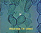 (leaf of dicotyledonous plant) Dicot leaf15.JPG