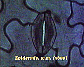 Stoma.JPG